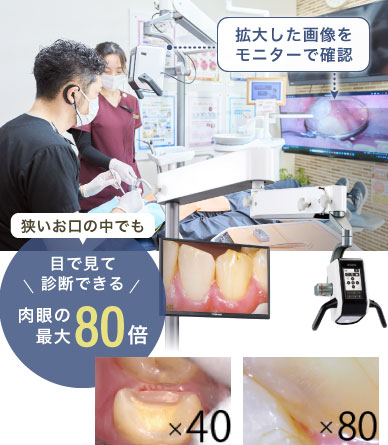 狭いお口の中でも目で見て診断できる肉眼の最大80倍!拡大した画像をモニターで確認